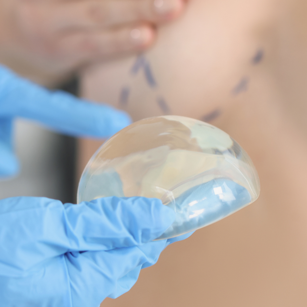 Breast Implant