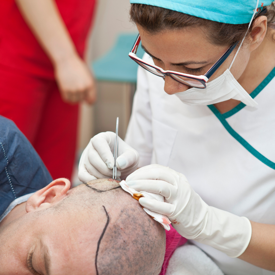 Hair transplantation