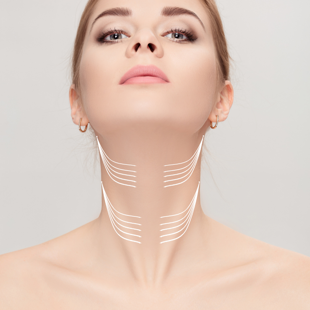 Neck Lift